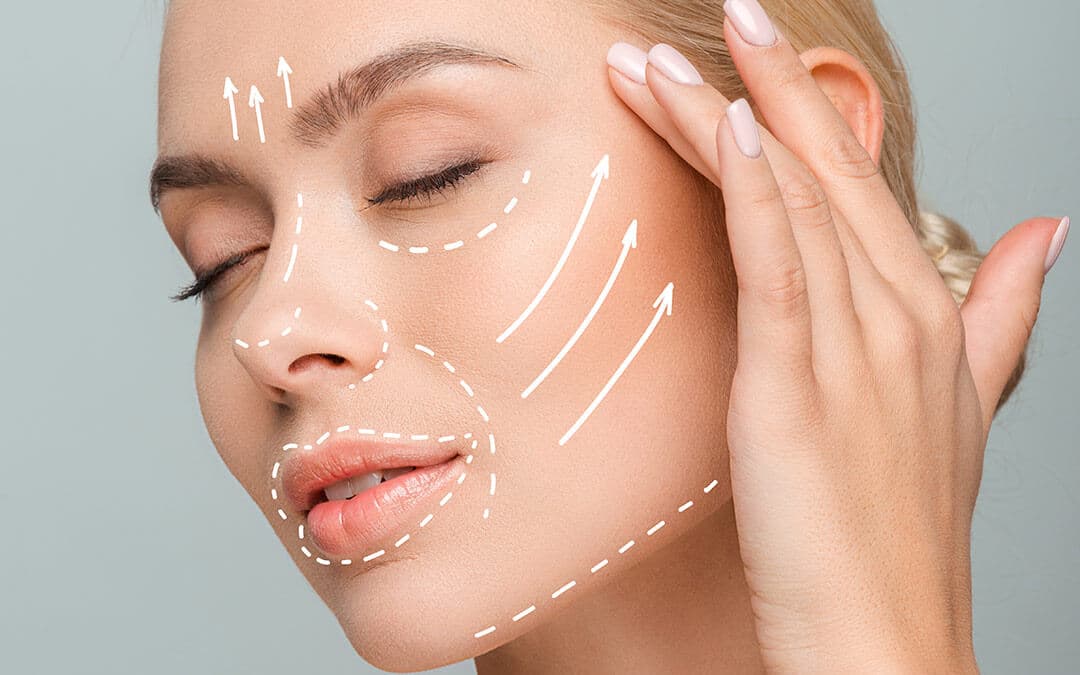 Lifting Facial — imagen 1