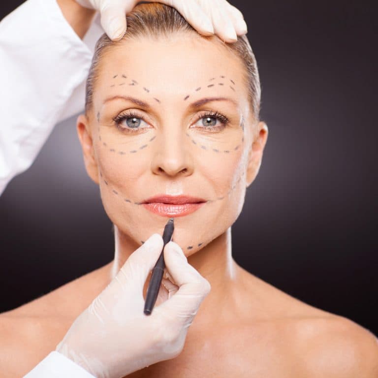 Lifting Facial — imagen 2