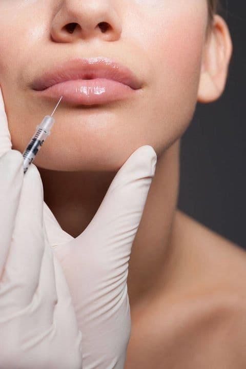 Baby Botox — imagen 2