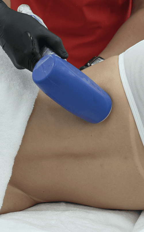 Hooke de Radiofrecuencia — MediSpa Caracas