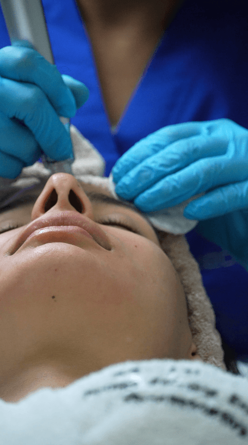 Hydrafacial — imagen 2