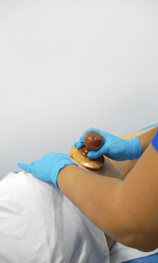 Maderoterapia — imagen 1